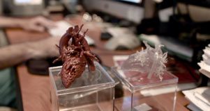 stratasys_3D_heart_model_nicklaus_medical