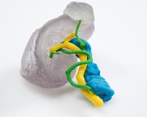 stratasys_3d_printed_spleen_model