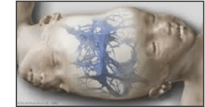 Medical-3D-Printing-Helps-Surgeons-Reduce-Complications-and-Save-Lives-3