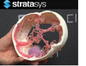 Medical-3D-Printing-Helps-Surgeons-Reduce-Complications-and-Save-Lives-4