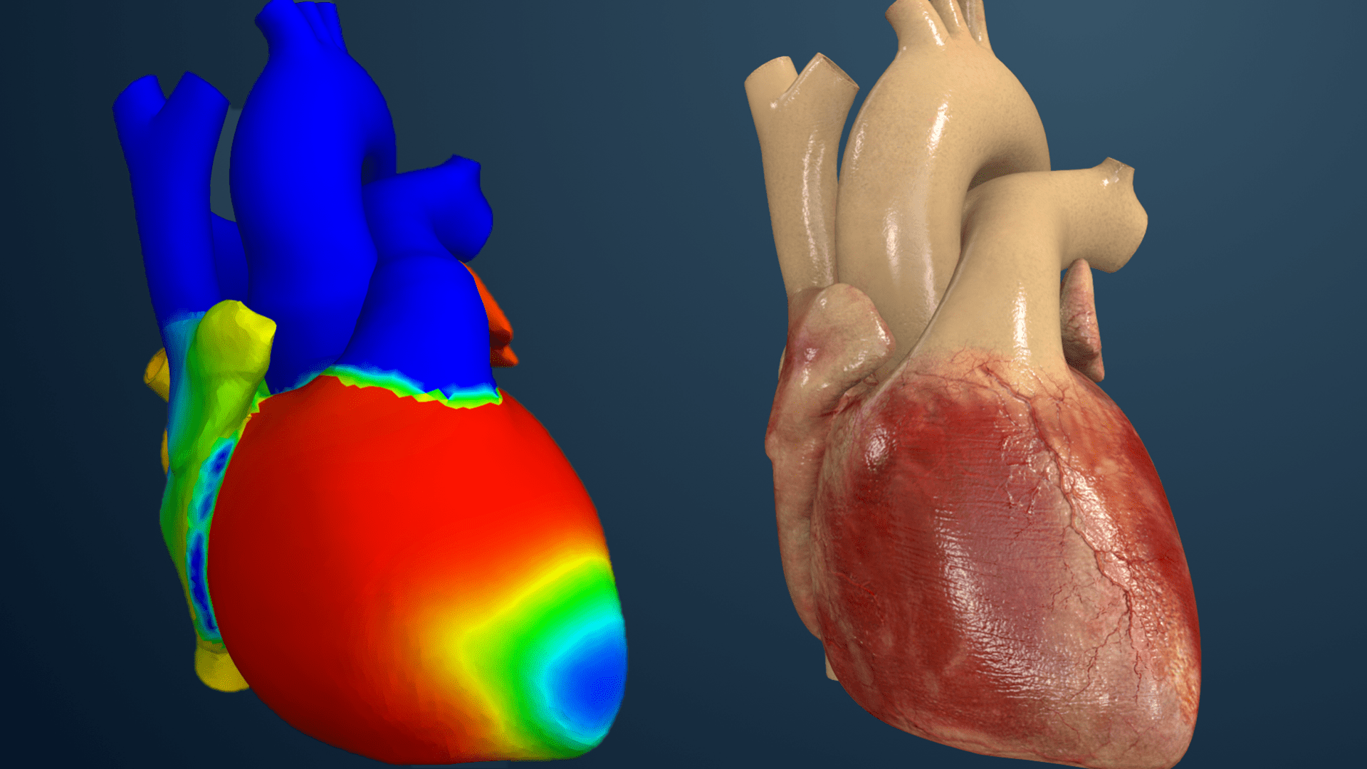 Living Heart Human Model (SHH)