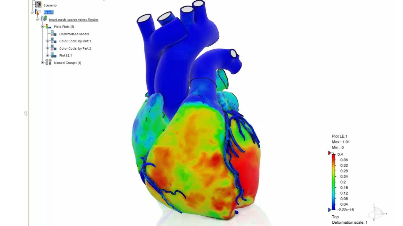 Living Heart Human Model (SHH)